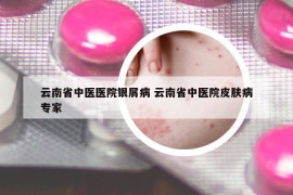 云南省中醫(yī)醫(yī)院銀屑病 云南省中醫(yī)院皮膚病專家