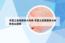 手臂上出現(xiàn)很多小白塊 手臂上出現(xiàn)很多小白塊怎么回事