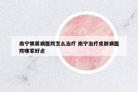 南寧銀屑病醫(yī)院怎么治療 南寧治療皮膚病醫(yī)院哪家好點(diǎn)