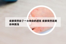 皮膚突然白了一小塊白的透亮 皮膚突然出現(xiàn)白塊很淺