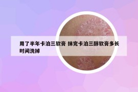 用了半年卡泊三軟膏 抹完卡泊三醇軟膏多長(zhǎng)時(shí)間洗掉