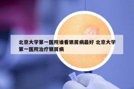 北京大學第一醫(yī)院誰看銀屑病最好 北京大學第一醫(yī)院治療銀屑病