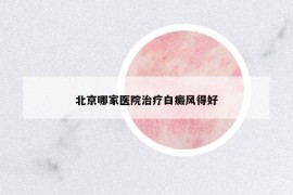 北京哪家醫(yī)院治療白癜風(fēng)得好