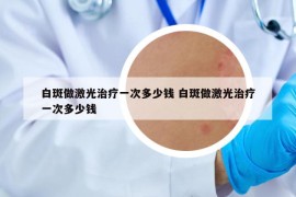 白斑做激光治療一次多少錢 白斑做激光治療一次多少錢