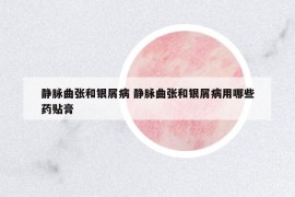 靜脈曲張和銀屑病 靜脈曲張和銀屑病用哪些藥貼膏