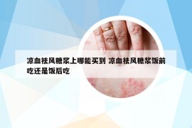 涼血祛風(fēng)糖漿上哪能買(mǎi)到 涼血祛風(fēng)糖漿飯前吃還是飯后吃