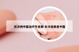 長沙純中醫(yī)治療牛皮癬 長沙皮膚老中醫(yī)