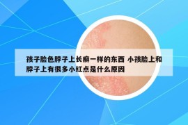 孩子臉色脖子上長癬一樣的東西 小孩臉上和脖子上有很多小紅點(diǎn)是什么原因