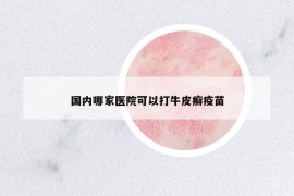 國內(nèi)哪家醫(yī)院可以打牛皮癬疫苗