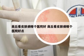 商丘看皮膚病哪個醫(yī)院好 商丘看皮膚病哪個醫(yī)院好點(diǎn)