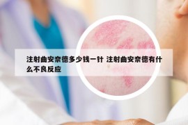 注射曲安奈德多少錢一針 注射曲安奈德有什么不良反應(yīng)