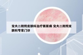 交大二附院皮膚科治療銀屑病 交大二附院皮膚科專(zhuān)家門(mén)診