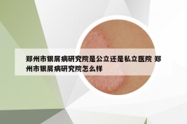 鄭州市銀屑病研究院是公立還是私立醫(yī)院 鄭州市銀屑病研究院怎么樣