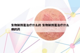生物制劑是治療什么的 生物制劑是治療什么病的藥
