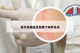 患牛皮癬適合在哪個城市生活