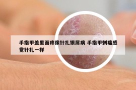 手指甲蓋里面疼像針扎銀屑病 手指甲刺痛感覺針扎一樣