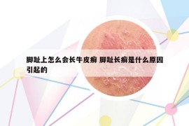 腳趾上怎么會(huì)長(zhǎng)牛皮癬 腳趾長(zhǎng)癬是什么原因引起的