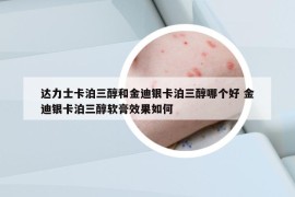 達(dá)力士卡泊三醇和金迪銀卡泊三醇哪個(gè)好 金迪銀卡泊三醇軟膏效果如何