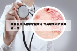 西昌看皮膚病哪家醫(yī)院好 西昌哪里看皮膚專業(yè)一些