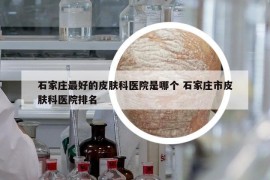 石家莊最好的皮膚科醫(yī)院是哪個(gè) 石家莊市皮膚科醫(yī)院排名