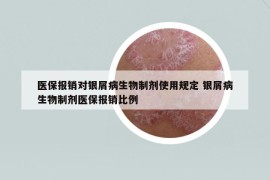 醫(yī)保報(bào)銷對(duì)銀屑病生物制劑使用規(guī)定 銀屑病生物制劑醫(yī)保報(bào)銷比例