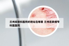 蘭州皮膚科醫(yī)院的地址在哪里 蘭州皮膚病?？漆t(yī)醫(yī)院
