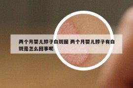 兩個(gè)月嬰兒脖子白斑圖 兩個(gè)月嬰兒脖子有白斑是怎么回事呢