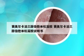 賽美爾卡泊三醇倍他米松凝膠 賽美爾卡泊三醇倍他米松凝膠說明書