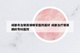 成都市治銀屑病哪家醫(yī)院最好 成都治療銀屑病的專科醫(yī)院