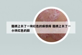 胳膊上長了一塊紅色的癬很癢 胳膊上長了一小塊紅色的蘚