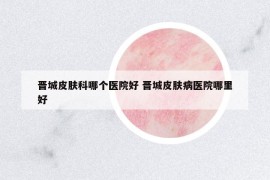 晉城皮膚科哪個(gè)醫(yī)院好 晉城皮膚病醫(yī)院哪里好