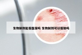 生物制劑能報(bào)醫(yī)保嗎 生物制劑可以報(bào)銷嗎