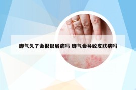 腳氣久了會(huì)很銀屑病嗎 腳氣會(huì)導(dǎo)致皮膚病嗎