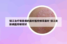 鎮(zhèn)江治療銀屑病的最好醫(yī)院哪家最好 鎮(zhèn)江皮膚病醫(yī)院哪家好