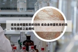 皮白金抑菌乳膏的功效 皮白金抑菌乳膏的功效作用臉上能用嗎