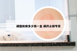 藏醫(yī)除癬多少錢(qián)一盒 藏藥止癬專(zhuān)家