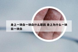 身上一塊白一塊白什么原因 身上為什么一塊白一塊白