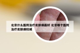 北京什么醫(yī)院治療皮膚病最好 北京哪個醫(yī)院治療皮膚病權(quán)威