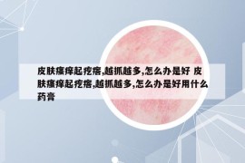皮膚瘙癢起疙瘩,越抓越多,怎么辦是好 皮膚瘙癢起疙瘩,越抓越多,怎么辦是好用什么藥膏