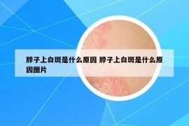 脖子上白斑是什么原因 脖子上白斑是什么原因圖片