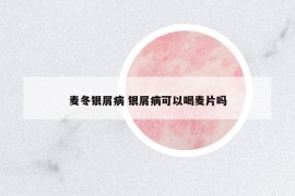 麥冬銀屑病 銀屑病可以喝麥片嗎