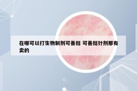 在哪可以打生物制劑可善挺 可善挺針劑那有賣的