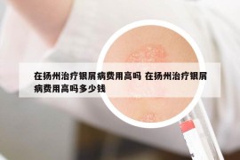 在揚(yáng)州治療銀屑病費(fèi)用高嗎 在揚(yáng)州治療銀屑病費(fèi)用高嗎多少錢