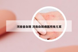 河南省白斑 河南白斑病醫(yī)院有幾家