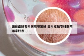 四川皮膚專科醫(yī)院哪家好 四川皮膚?？漆t(yī)院哪家好點(diǎn)
