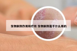 生物制劑作用和療效 生物制劑是干什么用的
