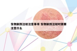 生物制劑注射注意事項(xiàng) 生物制劑注射時(shí)需要注意什么