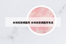 水城皮膚病醫(yī)院 水城皮膚病醫(yī)院電話