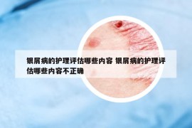 銀屑病的護(hù)理評估哪些內(nèi)容 銀屑病的護(hù)理評估哪些內(nèi)容不正確
