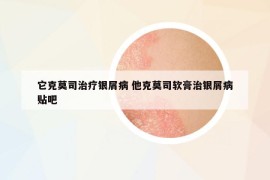 它克莫司治療銀屑病 他克莫司軟膏治銀屑病貼吧
